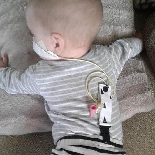 Baby wearing a striped shirt with a tubing clip on a soft surface