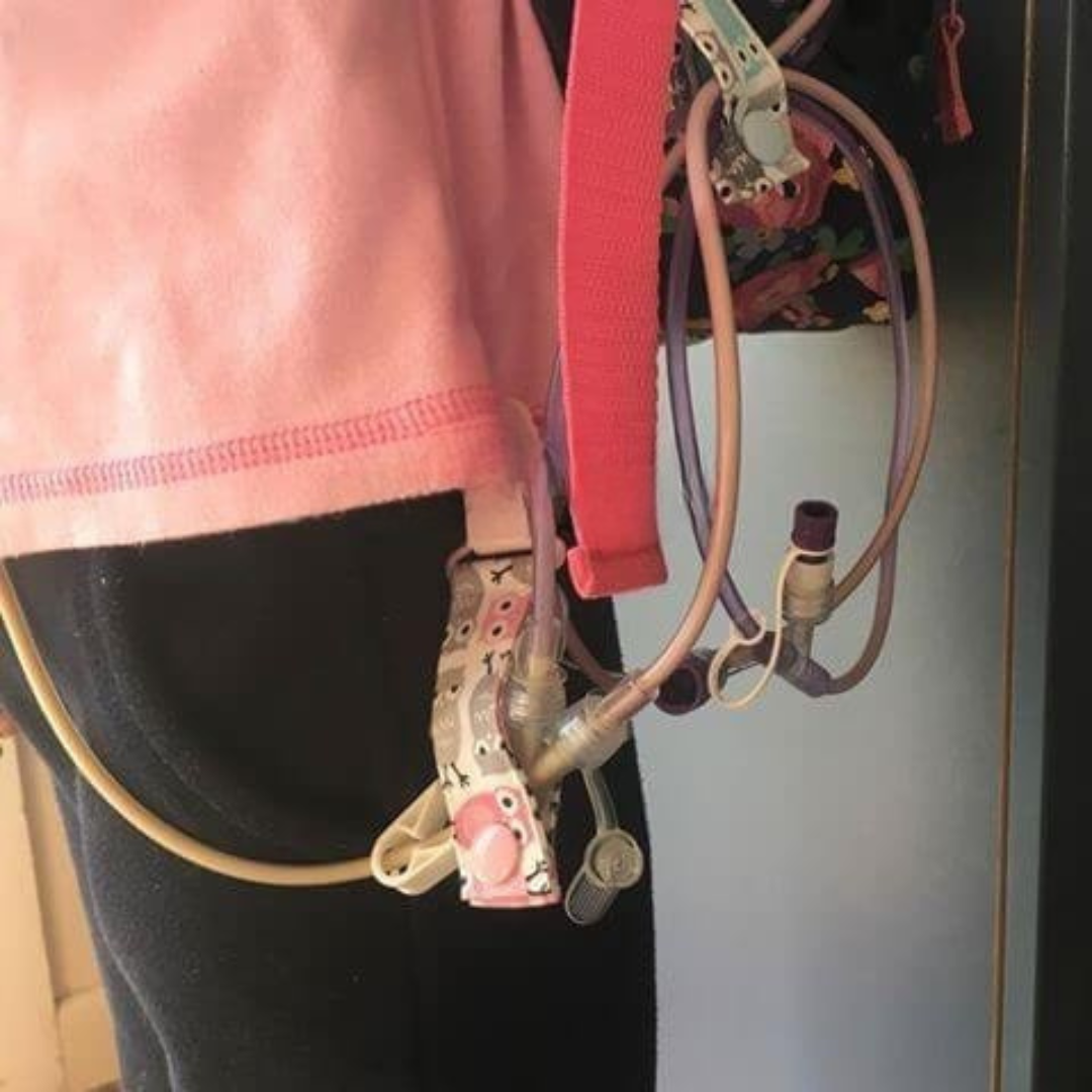 Close-up of a person wearing a pink jacket with visible tubing clips on a plain background