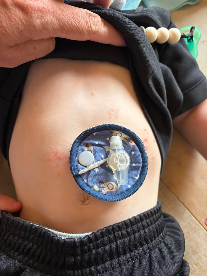 G Tube Pad x 3 pack